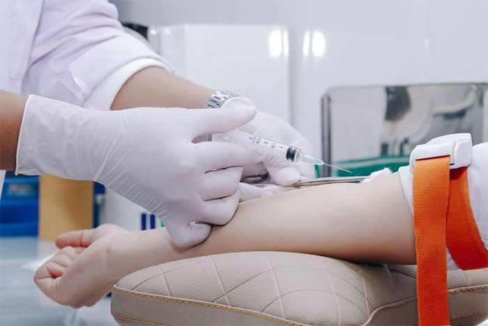 Bệnh viêm gan siêu vi B là gì?