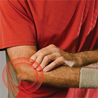 Hội chứng tennis elbow là gì?
