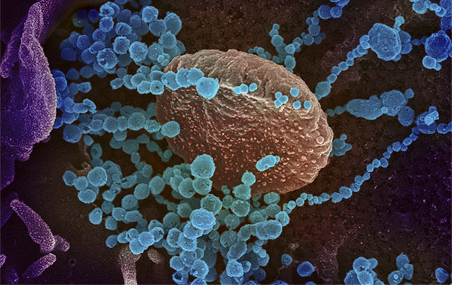 Sóng siêu âm có thể tiêu diệt virus SARS-CoV-2
