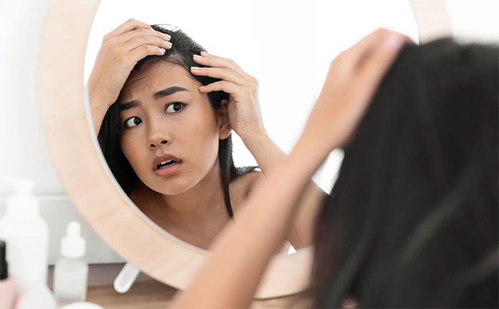 Căng thẳng kéo dài có thể dẫn đến hiện tượng rụng tóc.