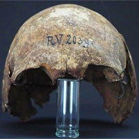 Phát hiện hộp sọ 5.000 năm tuổi của người đầu tiên từng nhiễm bệnh dịch hạch