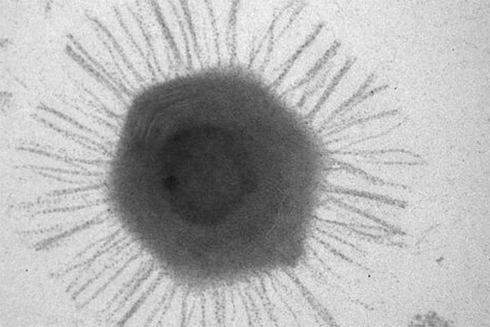 Hình quan sát dưới kính hiển vi điện tử của mimivirus.