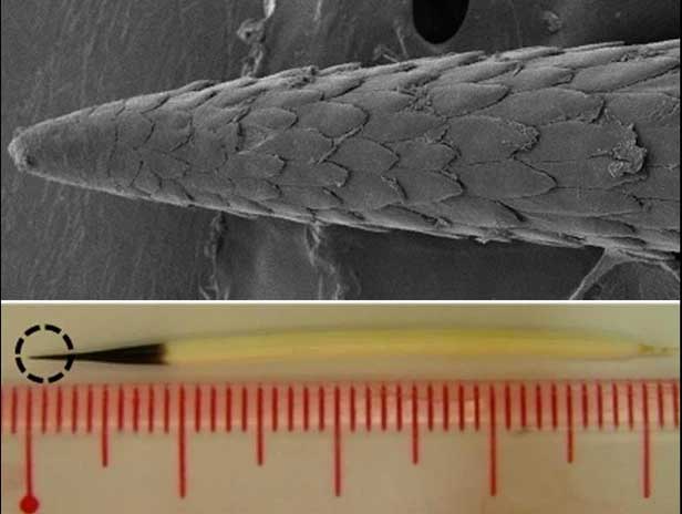 Lông nhím khi phóng to.