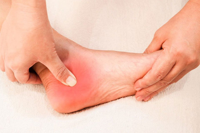 Đau gót chân: Nguyên nhân, triệu chứng và cách điều trị
