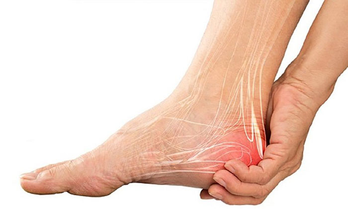Đau gót chân: Nguyên nhân, triệu chứng và cách điều trị
