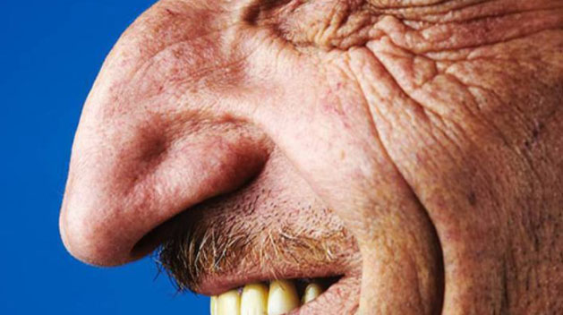 Dị nhân mũi siêu to phiên bản đời thực phá vỡ mọi quy luật bình thường