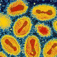 Những virus gây bệnh dịch chết người từng "biến mất không dấu vết"