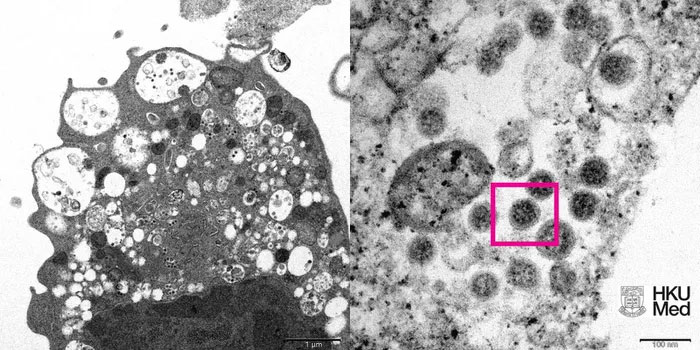Image of the Omicron variant of the SARS-CoV-2 virus under an electron microscope
