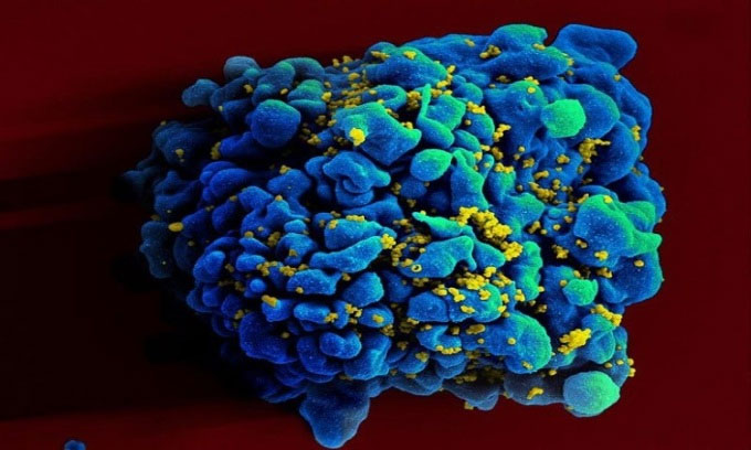 Ảnh chụp bằng kính hiển vi điện tử quét tế bào T H9 nhiễm HIV.
