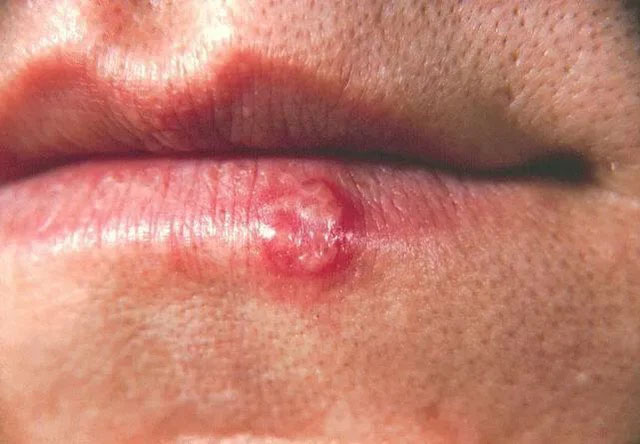 Sau 8 tiếng, loại virus này sẽ chui vào não và nó sẽ trở thành bất tử