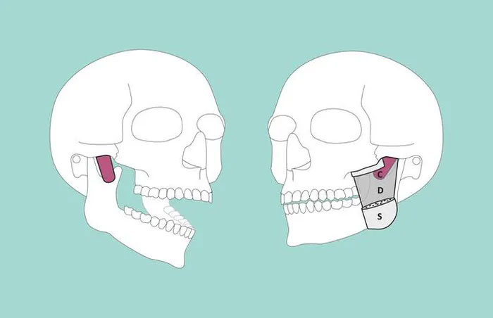 Ảnh đồ họa mô tả cấu trúc được phát hiện trong cơ thể người, cụ thể là vùng hàm.