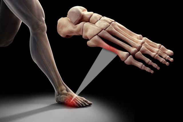 Tại sao người châu Á chỉ có 204 chiếc xương trong khi người Châu Âu và Châu Mỹ có đến 206 chiếc?