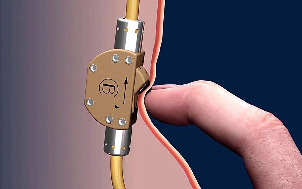 Hạt nano sưởi ấm tinh hoàn có thể giúp nam giới tránh thai trong 7 ngày
