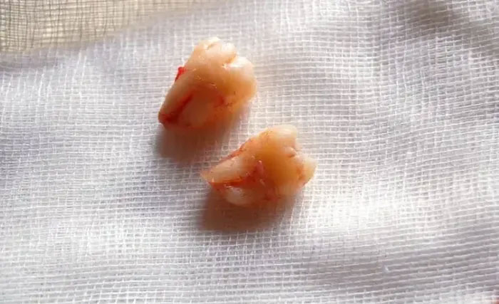 Top 7 ví dụ đáng ngạc nhiên về sự tiến hóa của con người gần đây
