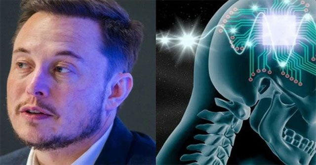 Công ty của Elon Musk chuẩn bị cấy ghép chip vào não người để "chế tạo" siêu nhân