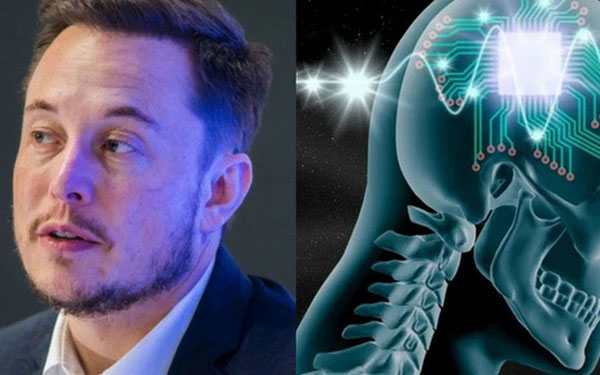 Công ty của Elon Musk chuẩn bị cấy ghép chip vào não người để 