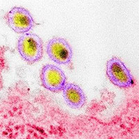 Lời cảnh báo cho đại dịch Covid-19 nhìn từ chủng HIV mới