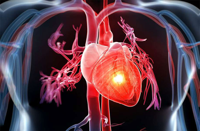 Suy tim là tim bị yếu đi, không đủ khả năng tiếp nhận máu, bơm máu đi nuôi cơ thể.