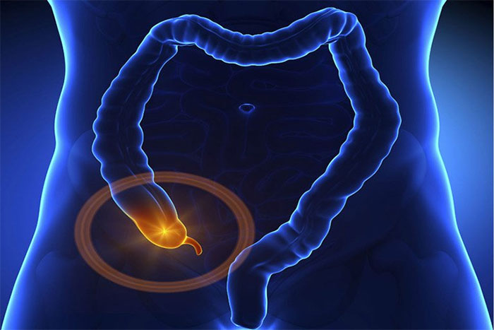 Tắc ruột non: Nguyên nhân, triệu chứng và cách điều trị