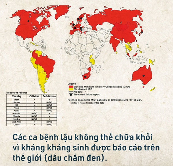 Biểu đồ bệnh lậu trên thế giới