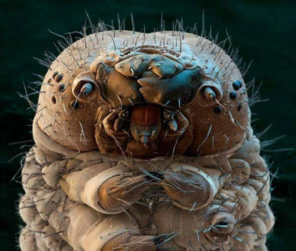 Bạn có biết: Dưới da mặt bạn, hàng trăm con bọ "siêu nhỏ" ung dung sống?