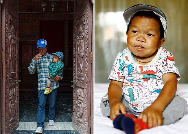 Chàng trai Nepal nhận danh hiệu nam thanh niên lùn nhất thế giới với chiều cao 73,43cm