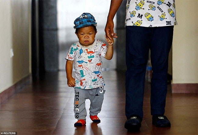 Chàng trai Nepal nhận danh hiệu nam thanh niên lùn nhất thế giới với chiều cao 73,43cm