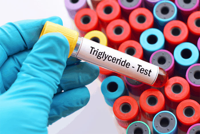 Xét nghiệm chỉ số triglyceride có thể báo hiệu tình trạng viêm ở tuyến tụy