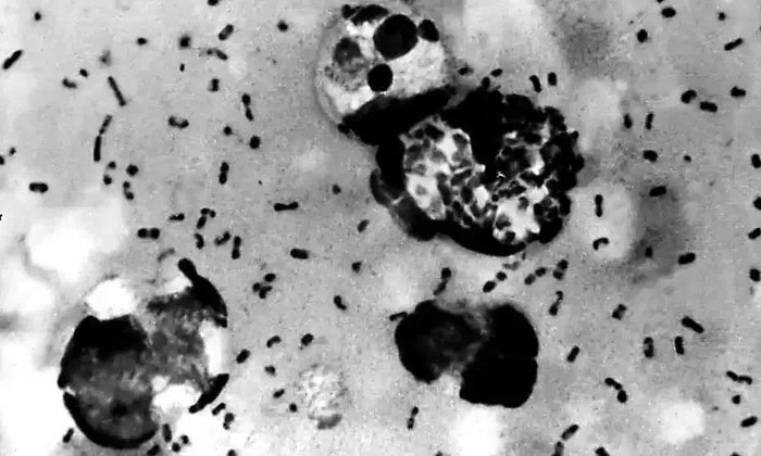 Vi khuẩn bệnh dịch hạch được chụp từ một bệnh nhân năm 2003.