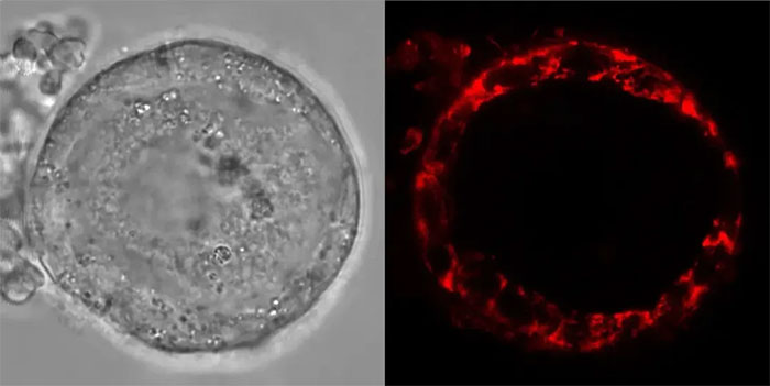  Tế bào trứng của con người đặc biệt độc đáo. 