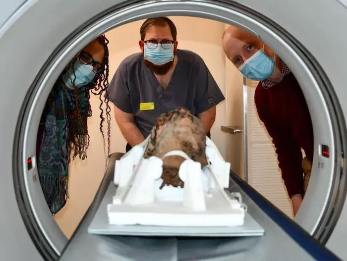 Các nhà khoa học bên chiếc đầu người đang được đưa vào máy CT