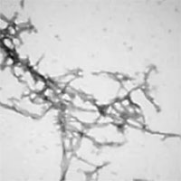 Phương pháp mới "ngăn" Parkinson bằng công nghệ nano