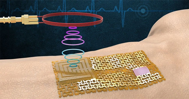 Cảm biến sức khỏe không cần chip, dán trực tiếp lên da