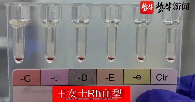 Trung Quốc phát hiện 2 phụ nữ có nhóm máu hiếm nhất thế giới