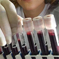 Phát hiện nhóm máu mới được mệnh danh là "siêu máu"