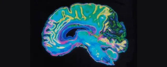  Hình ảnh MRI của não. 