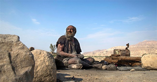 Người ở dơ nhất thế giới qua đời ít tháng sau khi tắm rửa