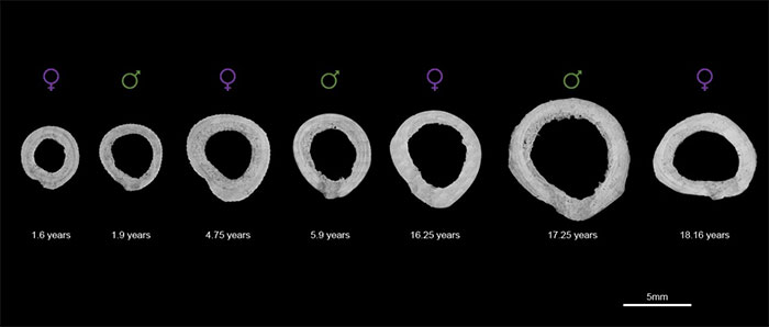 Hình ảnh hiển vi mặt cắt của 7 xương đùi được xác định theo tuổi và giới tính