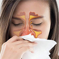Người viêm mũi dị ứng có 2 món không ăn - 3 món ăn nhiều để không khiến bệnh thêm trầm trọng