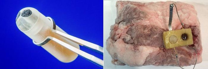 Các nhà khoa học phát triển cảm biến theo dõi mức glucose trong ruột