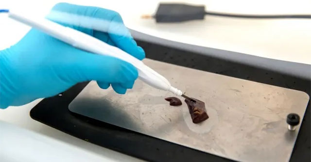 Thiết bị "đánh hơi" khối u phát hiện ung thư chỉ trong vài giây
