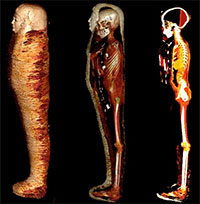 Tiết lộ mới về xác ướp "cậu bé vàng" 2.300 năm tuổi Ai Cập cổ đại