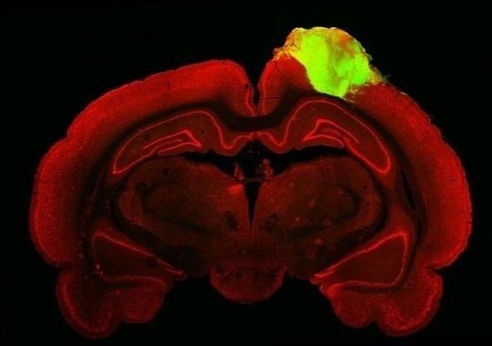  Hình ảnh mô học của não chuột với cơ quan vỏ não người được cấy ghép (màu xanh lá cây).