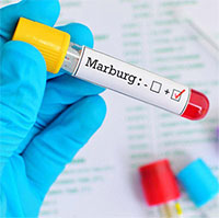 Bộ Y tế: Tăng cường giám sát bệnh Marburg đặc biệt nguy hiểm