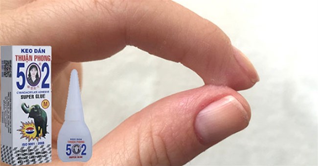 Cách gỡ keo 502 ra khỏi tay cực đơn giản