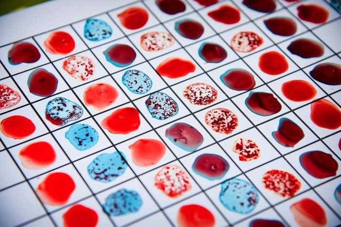 Chế độ dinh dưỡng tác động đến gene thế nào?