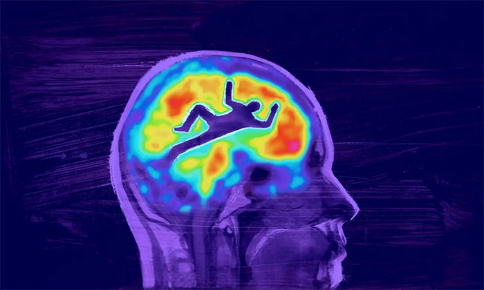  Hoạt động thể chất là một trong những yếu tố có liên quan đến sức khỏe não bộ. 