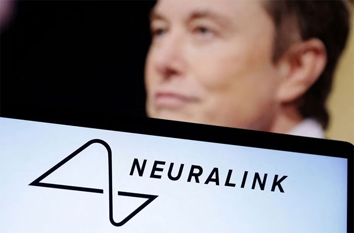 Chip cấy ghép não của Elon Musk sắp được thử nghiệm trên người