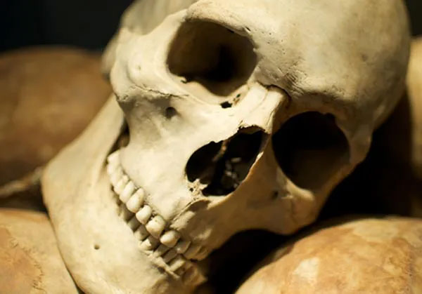 Vì sao người xưa thường có răng thẳng, răng khôn mọc đúng vị trí?
