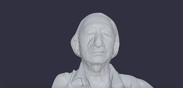 Các nhà nghiên cứu quét khuôn mặt của Lian trước khi tiến hành phẫu thuật.